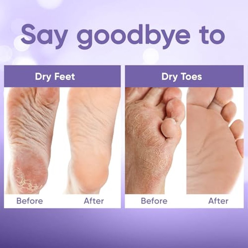 C?LOR Foot Peeling Mask for Dry Cracked Feet | Foot Mask to Exfoliate Rough, Cracked, Dry Feet, Calluses for Soft Baby Feet Results | Made with Aloe Vera Extract for Women & Men (2 Pairs) | Lavender