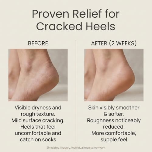 SEACRET Dead Sea Foot Cream 3.4 Fl Oz – Deep Moisturizing Heel Repair with Shea & Tea Tree Oil
