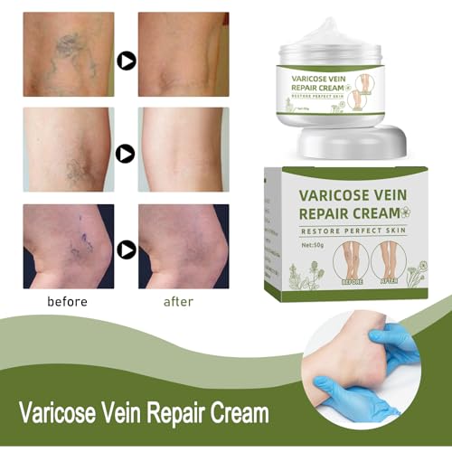 Varicose Veins Repair Cream - Leg Spider Vein Treatment Treatment 50g