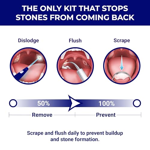 ORAVIX Tonsil Stone Removal Kit - 3-in-1 Oral Care Set for Bad Breath