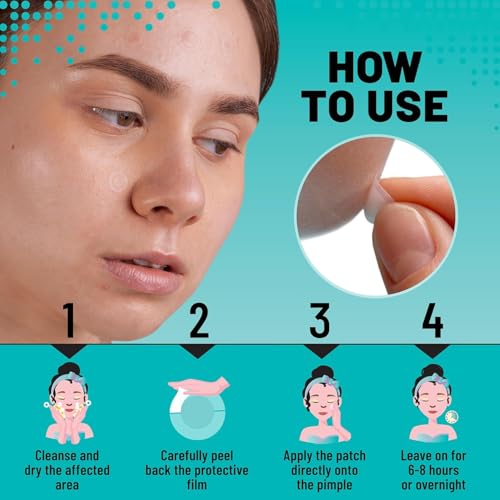 TOLEVITA Microdarts Acne Patches - 18 Count for Blemish Control