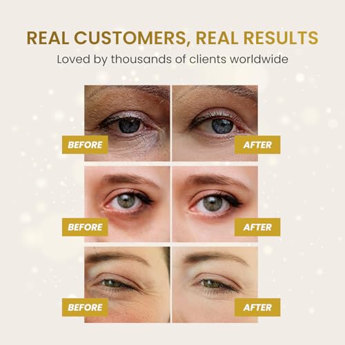 24K Gold Under Eye Patches - Reduce Dark Circles & Puffiness