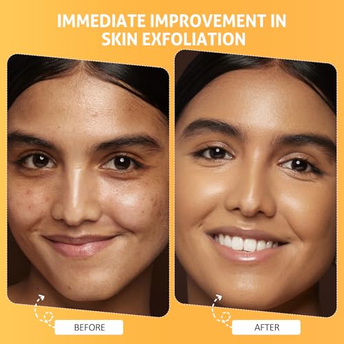 RIHAKO Pumpkin Enzyme Exfoliating Face Mask for Brightening Skin