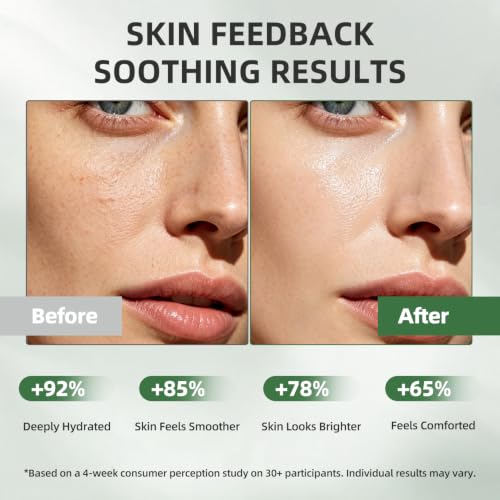 LOVAYON PDRN Salmon DNA Cica Soothing Serum - Hydrating Facial Care 1.01 fl oz