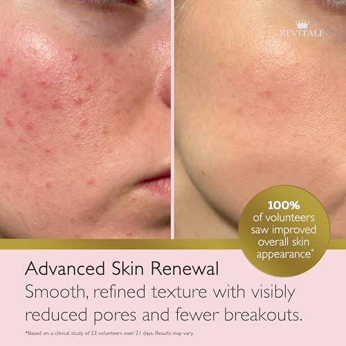 REVITALE Salicylic Acid Cream for Face & Body – 80g Blemish Control