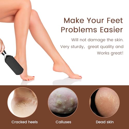 GAZEPLUS Colossal Foot Rasp Scraper - Stainless Steel Callus Remover