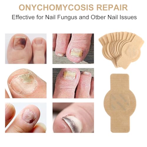 Toenail Repair Patches - 30 Hydrogel Nail Treatment for Damage