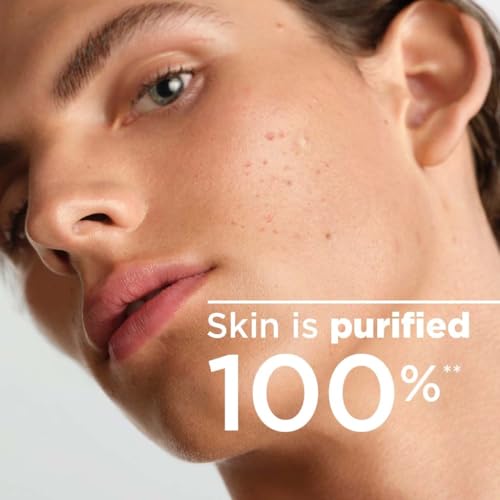 Bioderma Sébium Face Cleanser - Purifying Makeup Remover for Oily Skin