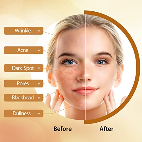 POP MODERN.C Kojic Acid Turmeric Soap Pack of 3 - Dark Spot Remover for Face & Body