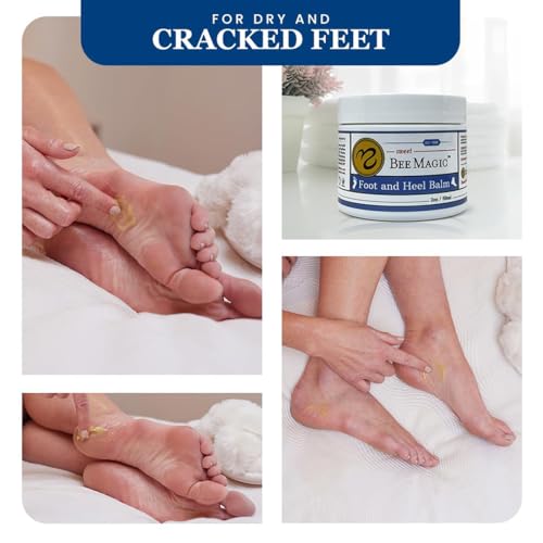 Sweet Bee Naturals Organic Foot Balm - Intensive Cracked Heel Treatment (2 OZ)