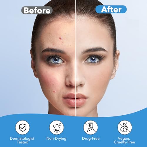 QUSTERE Hydrocolloid Pimple Patches - 282 Count in 3 Shapes