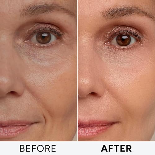 Retinol Cream with Collagen & Hyaluronic Acid - Anti-Aging Moisturizer