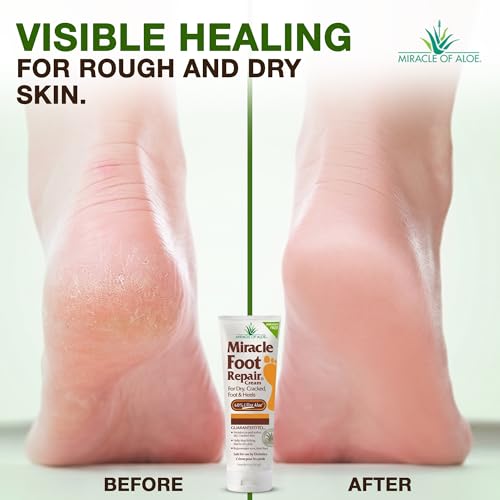 Miracle Foot Repair Cream, 4 Oz (Pack of 2) for Dry Cracked Feet
