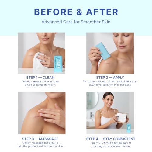 Suquato Silicone Scar Stick – Advanced Scar Treatment for Face & Body