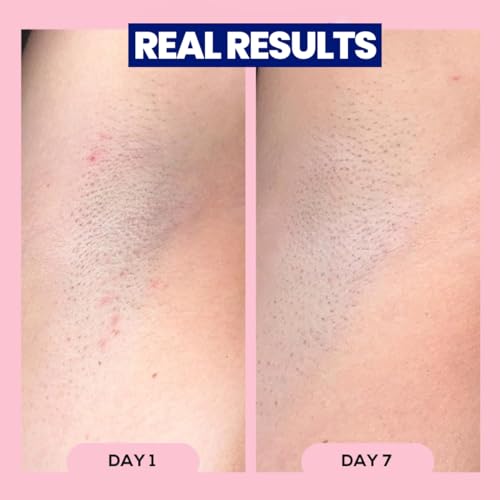 Megababe Apr?s Shave (3.0 fl oz) | Post-Shave & Waxing | Vacation and Hot Weather Must-Have | Ingrown Hair & Razor Bump Roll-On Treatment for Women | Bikini, Armpits & Legs
