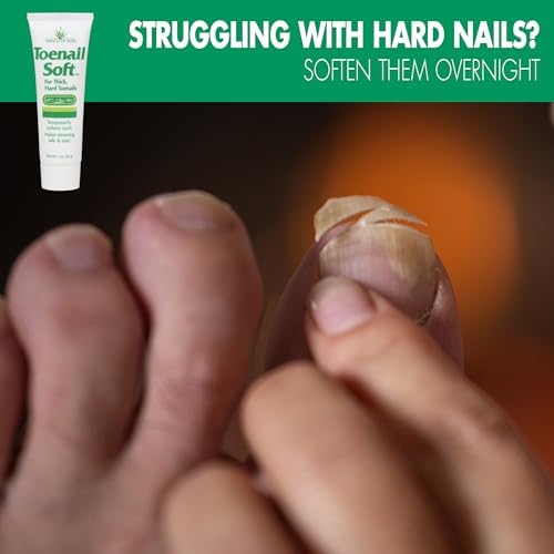 Toenail Softener for Thick Hard Toenails - Safe for Seniors & All Ages - Fast-Acting Toenail Softening Cream - Non Greasy Nail Cream Formulated with Natural Aloe Vera (1 Ounce Tube (Pack of 1))
