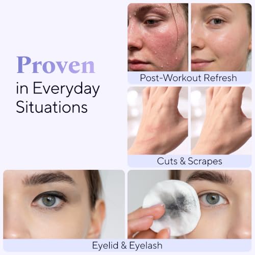 SAFOLYTE Hypochlorous Acid Face & Skin Spray 4oz - Gentle, Dermatologist Tested, Multi-Use for Acne, Eczema, Wounds