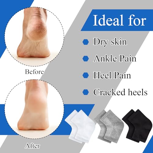 Moisturizing Toeless Socks for Dry Cracked Heels - 3 Pairs