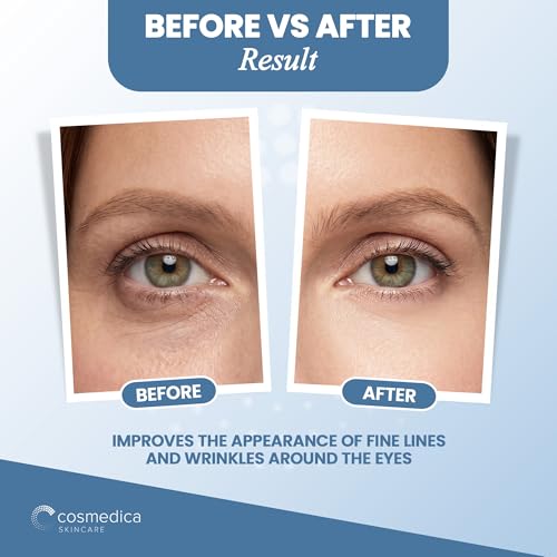 Cosmedica Skincare Anti-Aging Eye Cream for Dark Circles & Puffiness, 0.7 oz