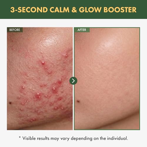 TOSOWOONG Mugwort Serum for Sensitive Skin - Hydrating & Calming