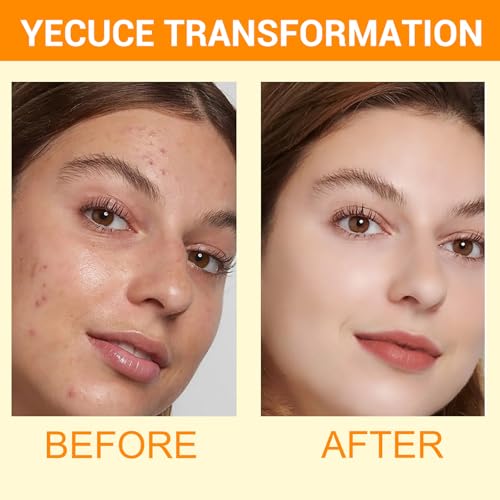 A r b c r n 2 Pack Turmeric Facial Cleanser with Kojic Acid, 150ML - Deep Pore & Skin Firming