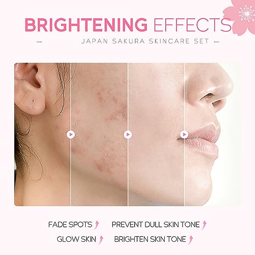 Cherry Blossom Skincare Set for Teen Girls - Moisturizing Gift Pack with Face Serum & Masks
