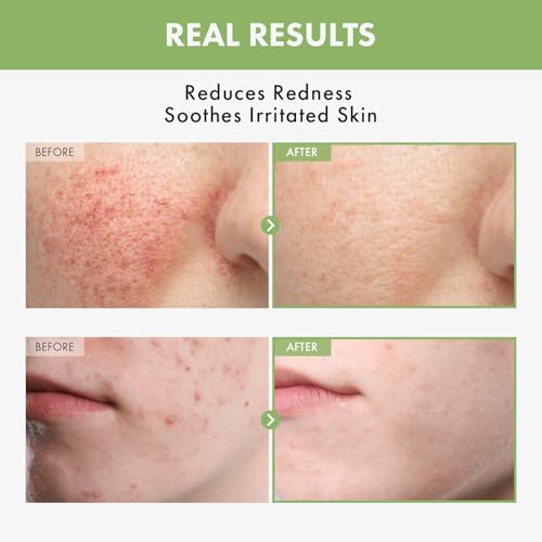TOSOWOONG Heartleaf 97% Face Toner for Sensitive Skin, Hydrating & Calming