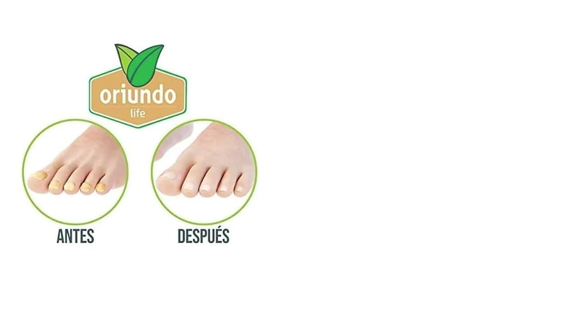 Oriundo Nail Treatment Solution - Strengthening Formula for Healthy Nails | 0.5 oz - 2 Pack