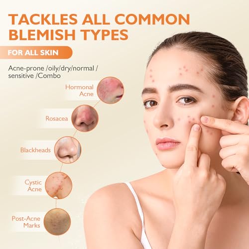 Natural Acne Treatment Balm for Face & Body – Hydrating, Non-Comedogenic Formula