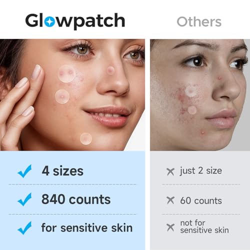 Glowpatch Pimple Patches - 840 Hydrocolloid Zit Stickers in 4 Sizes