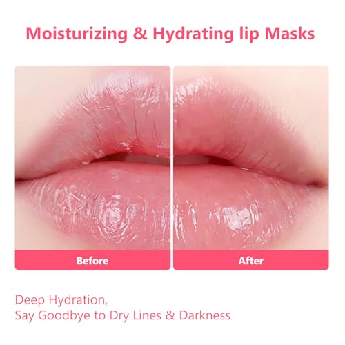 Adofect Pink Collagen Lip Patches - Hydrating Hydrogel Lip Mask for Dry, Wrinkled Lips, 30 Pack