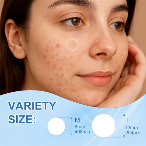 Amouy Acne Pimple Patch- 2 Sizes 612 Dots Thin & Thick Hydrocolloid