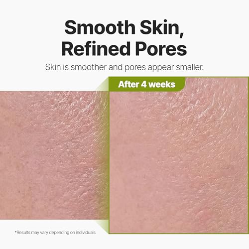 P.CALM Holy Basil Bubble Deep Mask 90g - Green | Blackhead & Pore Cleansing