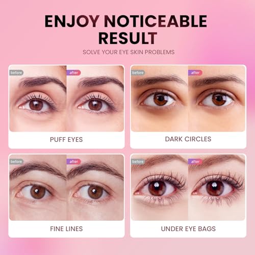 AILEORY Tri-Color Under Eye Patches - Hydrating Gel Pads for Dark Circles & Puffiness (24 Pairs)