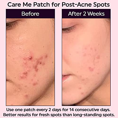 Microdart Dark Spot Patch - 9 Count Acne Treatment for Clearer Skin
