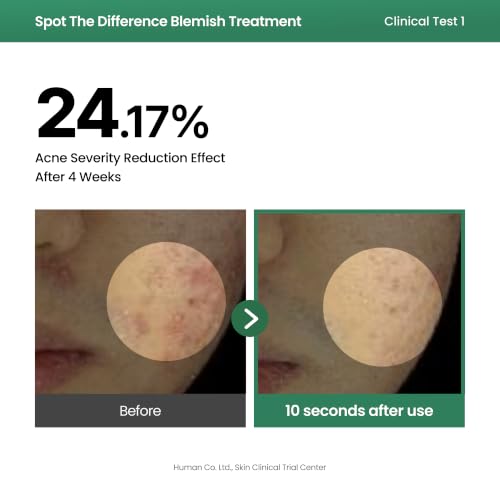 AXIS-Y Blemish Spot Treatment with 2% Niacinamide & AHA/BHA