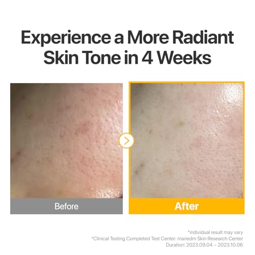 numbuzin No.5 Sheet Mask - Vitamin C & Glutathione for Radiance