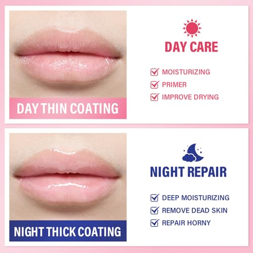 5 Pcs Bee Lip Balm Set - Honey, Strawberry, Watermelon, Apple Lime, Cherry - Moisturizing Overnight Lip Mask