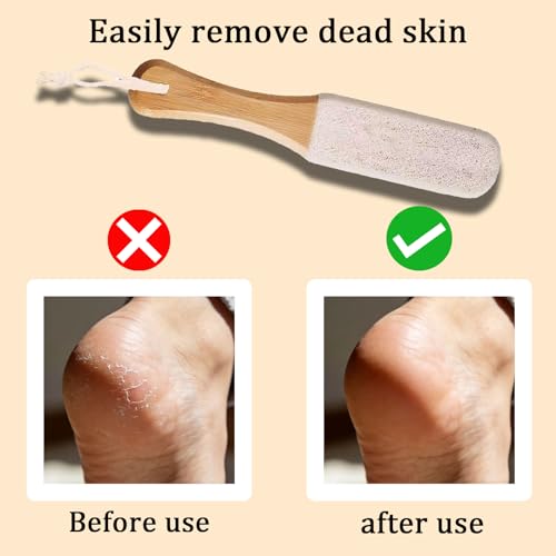 Professional Pedicure Foot File & Pumice Stone Set - Callus Remover