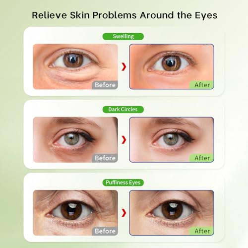 Reusable Gel Eye Pack Set | Cooling Eye Pads & Patches for Relief