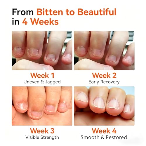 modelones Nail Biting Prevention for Kids - Bitter Thumb Sucking Deterrent - Quick Dry No Bite Nail Polish Pen - Stop Biting for Adults - Nail Repair & Care - Safe & Effective Solution For Age 1+