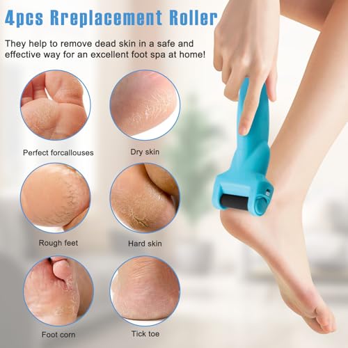 ZJchao 4-Pack Replacement Rollers for Callus Remover