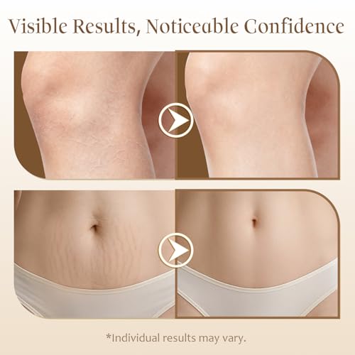 QAH Body Firming Oil with Massage Roller - Anti-Cellulite & Hydrating Serum