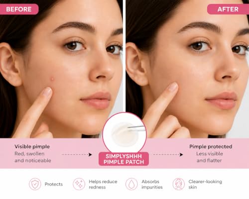 Hydrocolloid Pimple Patches for Face - 36 Count, 2 Sizes