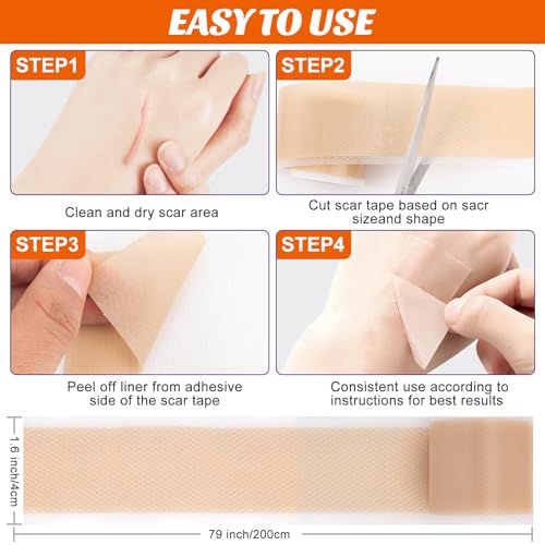 Medical-Grade Silicone Scar Tape for C-Section & Surgical Scars