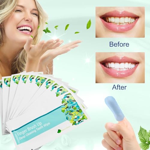 EZGO Teeth Cleaning Finger Wipes - 100 Individually Wrapped Mint Wipes