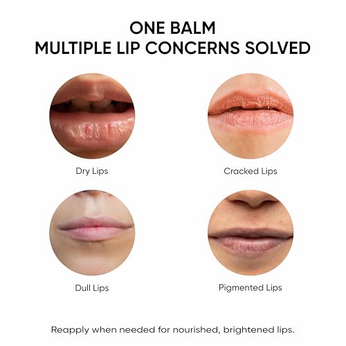 Masofta Kojic Acid & Shea Butter Lip Balm with SPF 30 - 15g