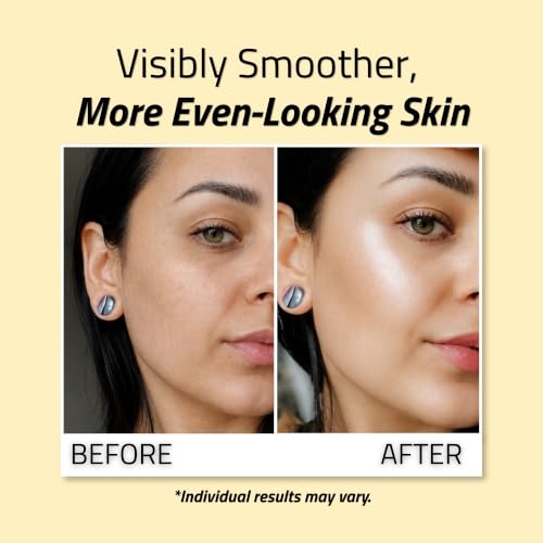 YEOUTH Niacinamide Serum with Hyaluronic Acid & Licorice Root 1oz – Brightening & Hydrating Face Serum