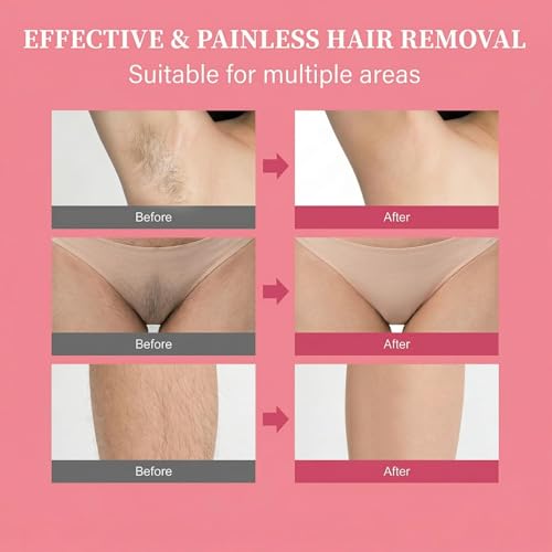 Body Hair Removal Cream for Women, Painless & Fast Acting for Legs, Bikini Line & Underarms, Sensitive Skin Friendly Depilatory Cream, 4.52 Oz
