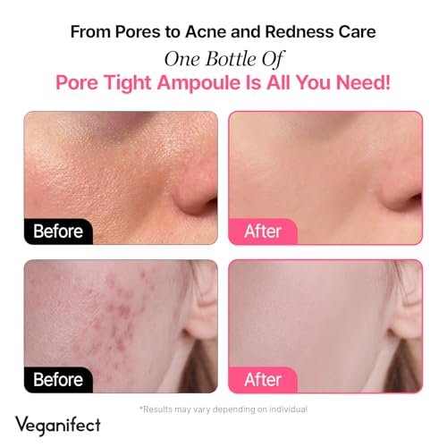 VEGANIFECT Pore Refining Ampoule with Fig & Chestnut Niacinamide – 8 Plant Extracts